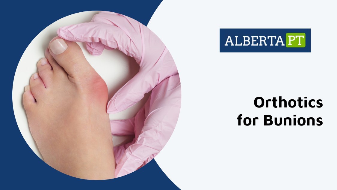 Best Orthotics For Bunions in Calgary SE